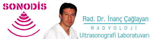 Radyoloji Ultrasonografi Laboratuvarı